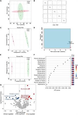 Effects of Sevoflurane Anesthesia on Cerebral Lipid Metabolism in the Aged Brain of Marmosets and Mice